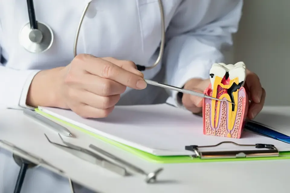 Dentist pointing to a cut-away tooth model that shows the pulp and roots