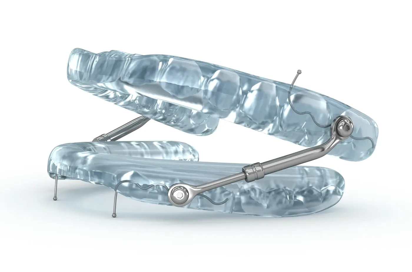 A custom oral appliance for snoring and sleep apnea: two clear trays for the upper and lower teeth joined at the sides